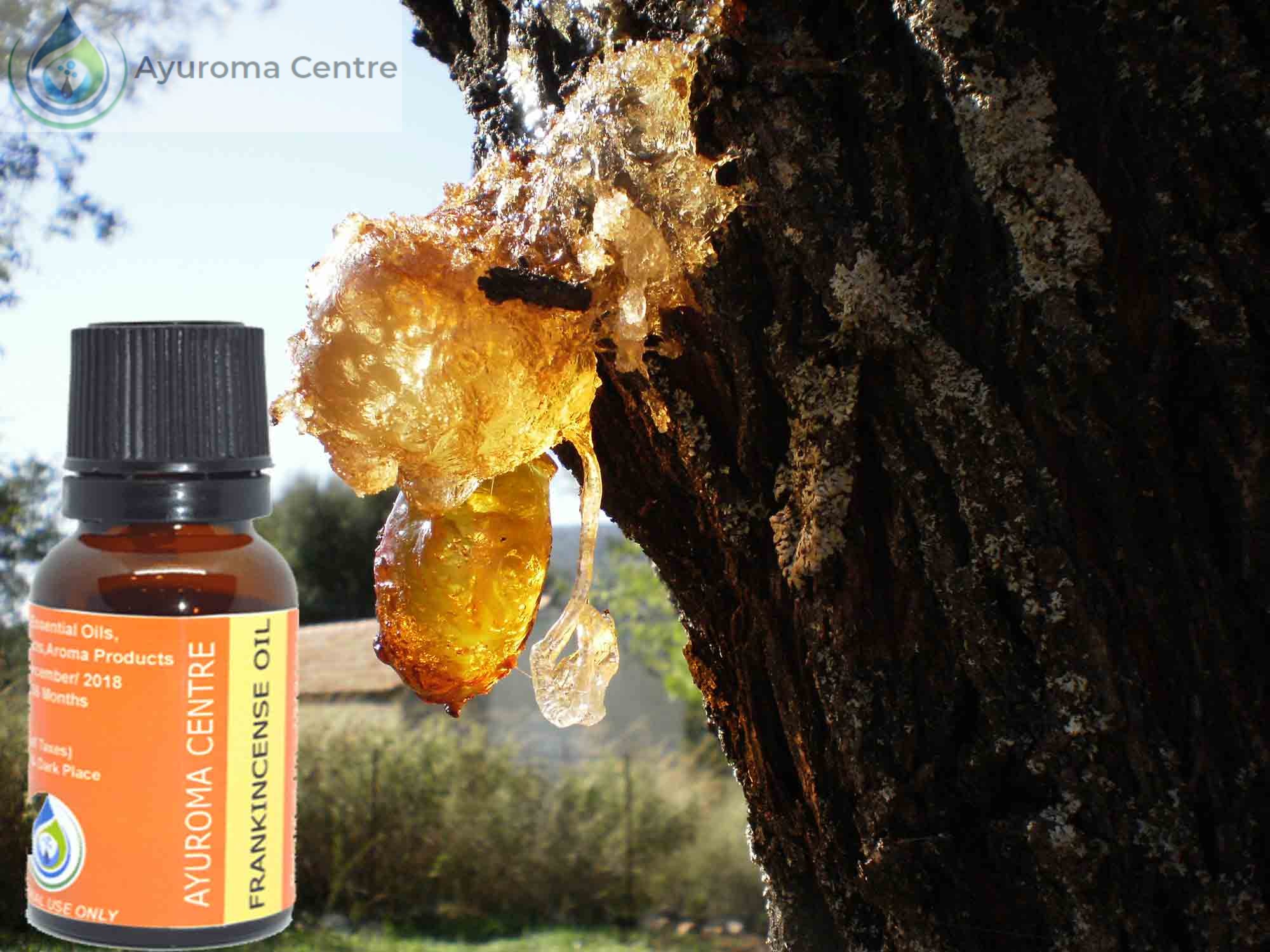 You are currently viewing Frankincense Oil And Its Benefits